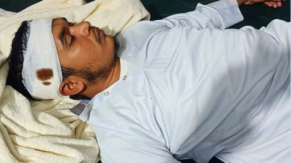 টেকনাফে আ.লীগ কর্মীদের হামলায় জামায়াতের ২ কর্মী আহত
