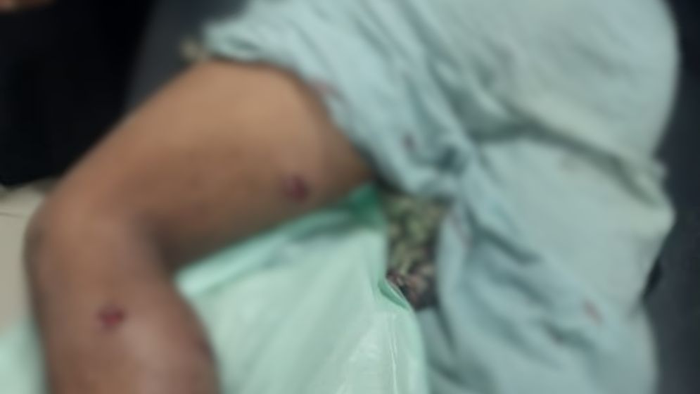 বান্দরবান সীমান্তে বাংলাদেশি গুলিবিদ্ধ