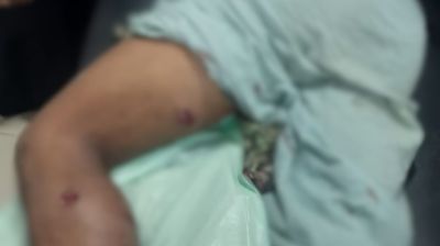 বান্দরবান সীমান্তে বাংলাদেশি গুলিবিদ্ধ