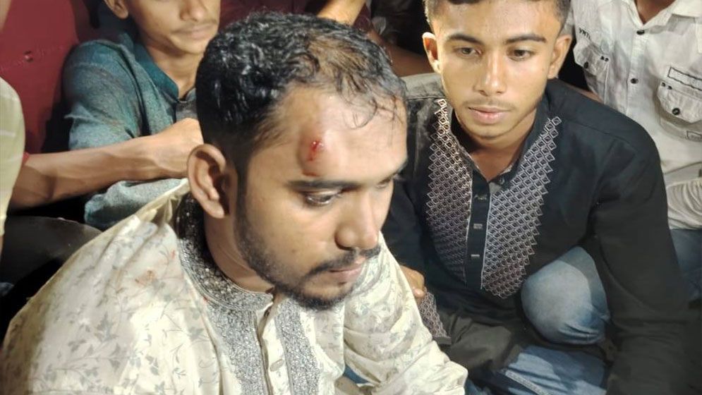 হাতিয়ায় আব্দুল হান্নান মাসউদের উপর হামলা