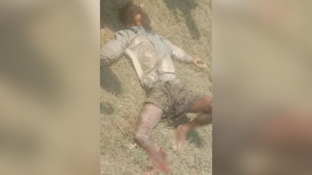 তোতার দ্বীপে মাইন বিস্ফোরণে বাংলাদেশির পা বিচ্ছিন্ন
