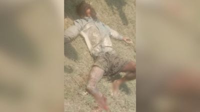 তোতার দ্বীপে মাইন বিস্ফোরণে বাংলাদেশির পা বিচ্ছিন্ন