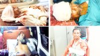 বাউফলে হাটের নিয়ন্ত্রণ নিয়ে সংঘর্ষ, ভুক্তভোগীদের বিরুদ্ধেই মামলা