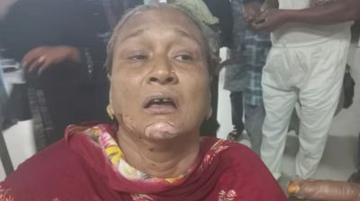 চট্টগ্রামে সিএনজিতে পেট্রলবোমা নিক্ষেপ, দগ্ধ ২