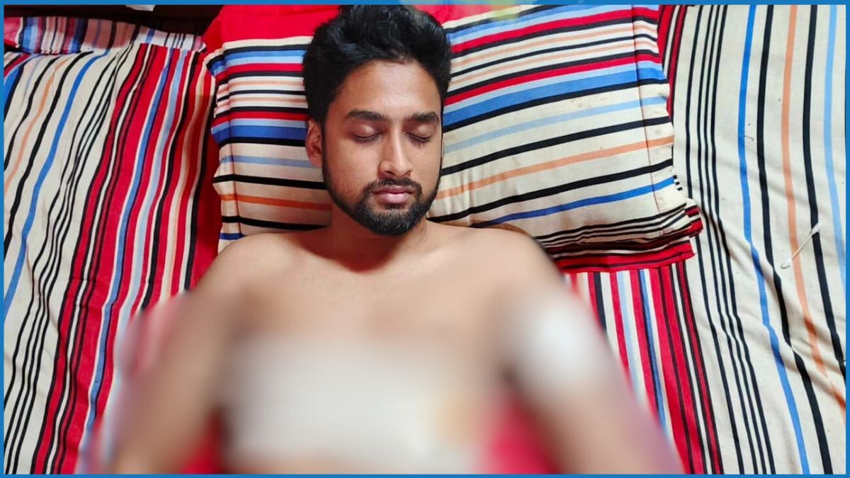 মাদক ব্যবসায় বাধা দেয়ায় কলেজ শিক্ষার্থীকে কুপিয়ে জখম