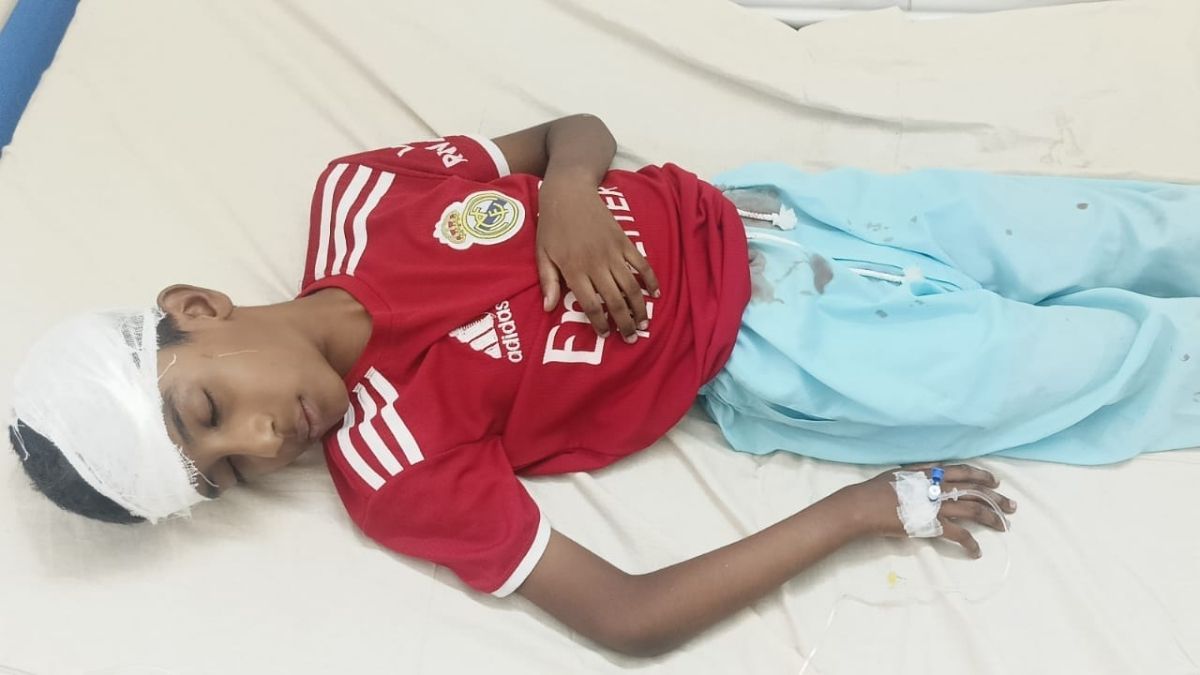 চাঁদপুরে ড্রেনের গ্যাস বিস্ফোরণে মা-ছেলেসহ আহত ৩