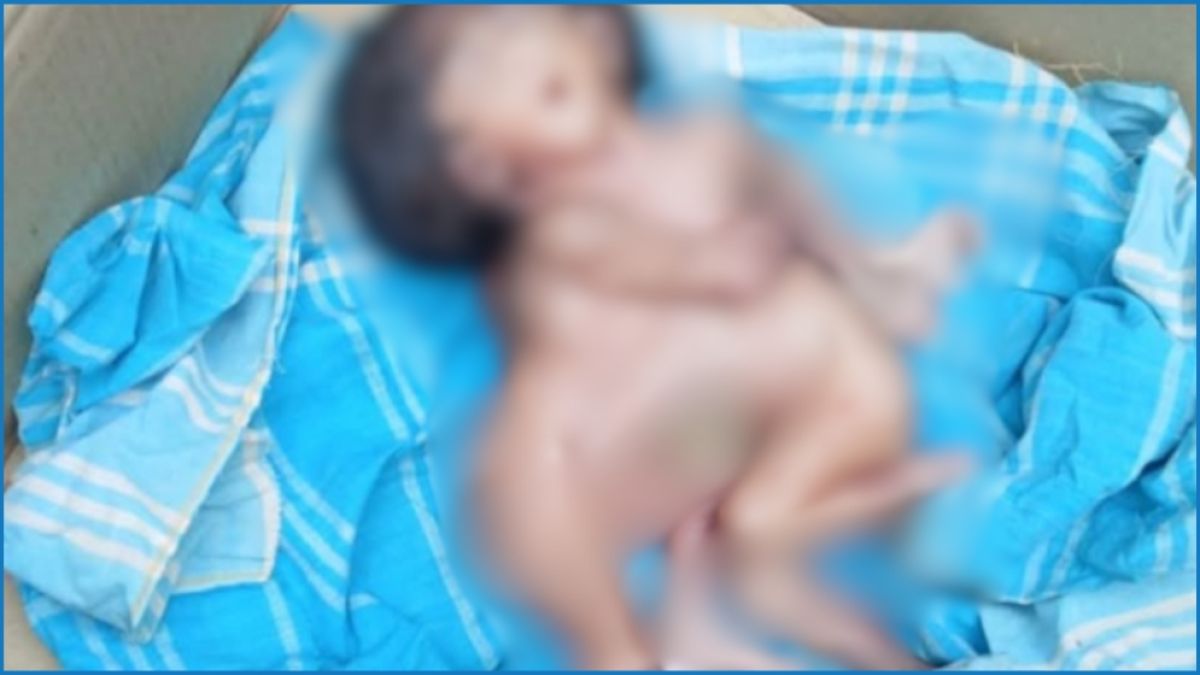নাটোরে জোড়া মাথার মৃত জমজ কন্যা শিশুর জন্ম