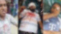 মতলবে বিএনপির দুই গ্রুপে সংঘর্ষ, পথচারীসহ আহত ১০