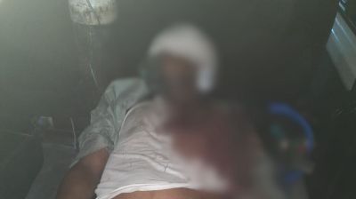 গাজীপুরে গাছ ফেলে পিকআপে ডাকাতি, নিহত ২