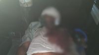 গাজীপুরে গাছ ফেলে পিকআপে ডাকাতি, নিহত ২
