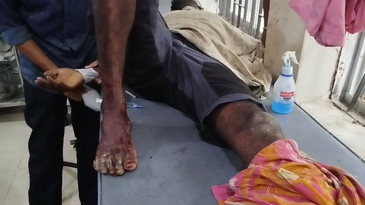 নাইক্ষ্যংছড়ি সীমান্তে ফের মাইন বিস্ফোরণ
