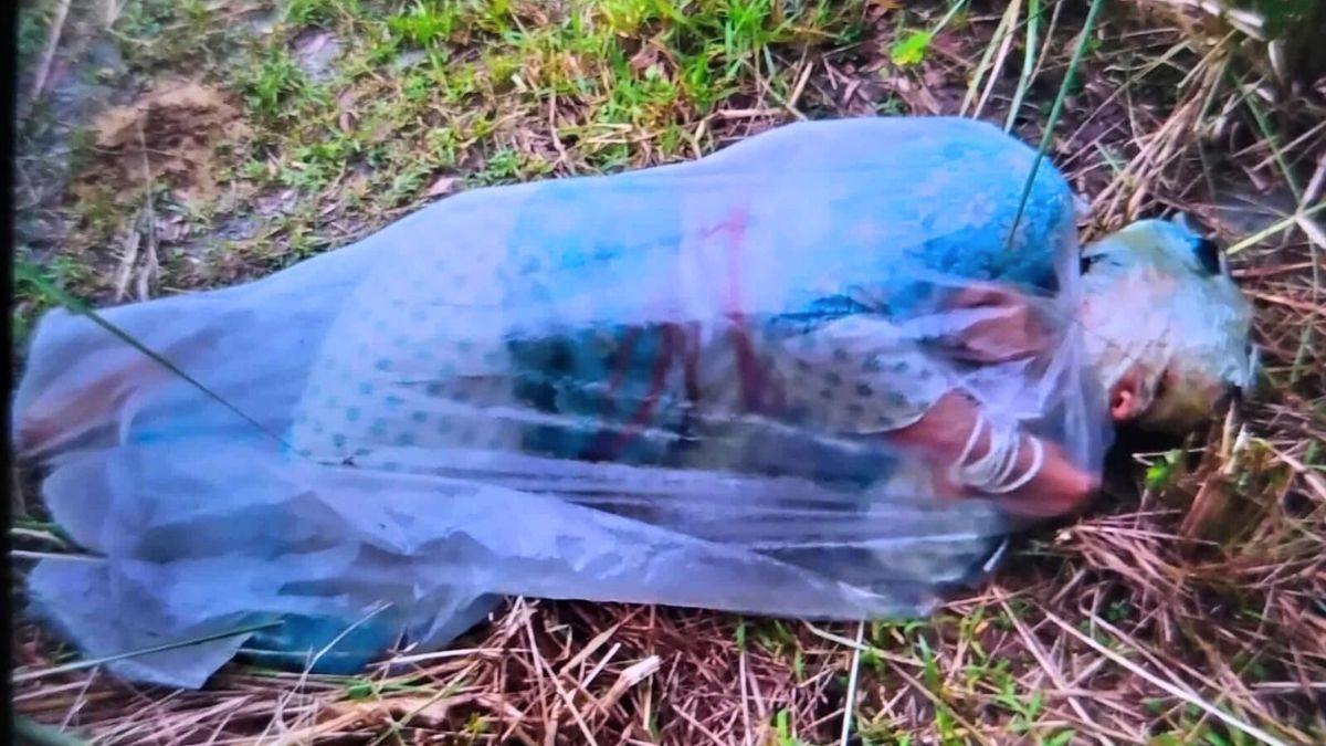 এসিডে ঝলসে দেওয়া হলো নারীর শরীর, অভিযোগ স্বামীর প্রথম স্ত্রী-শ্যালকের বিরুদ্ধে