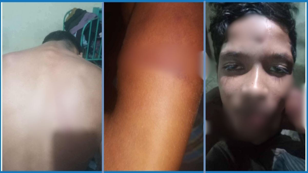 বরগুনায় সরকারি শিশু পরিবারে নির্যাতনের অভিযোগ