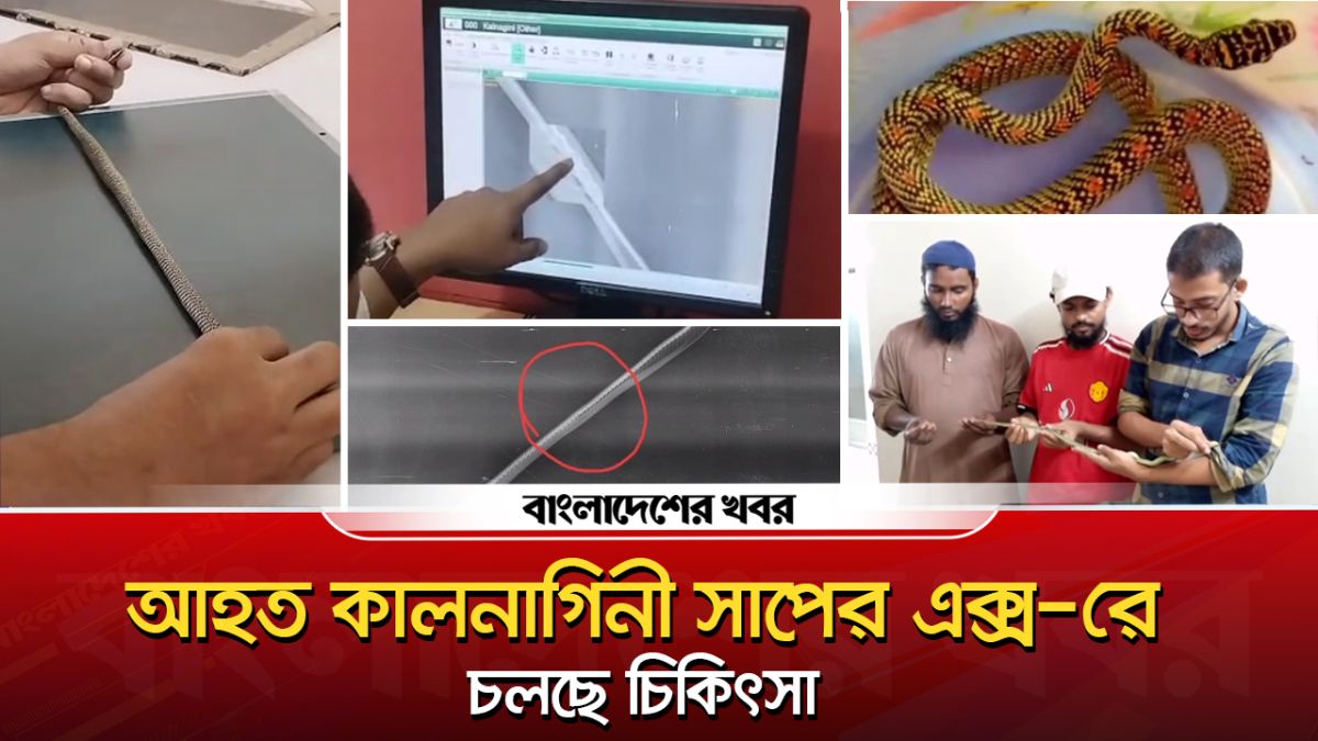 আহত কালনাগিনী সাপের এক্স-রে, চলছে চিকিৎসা