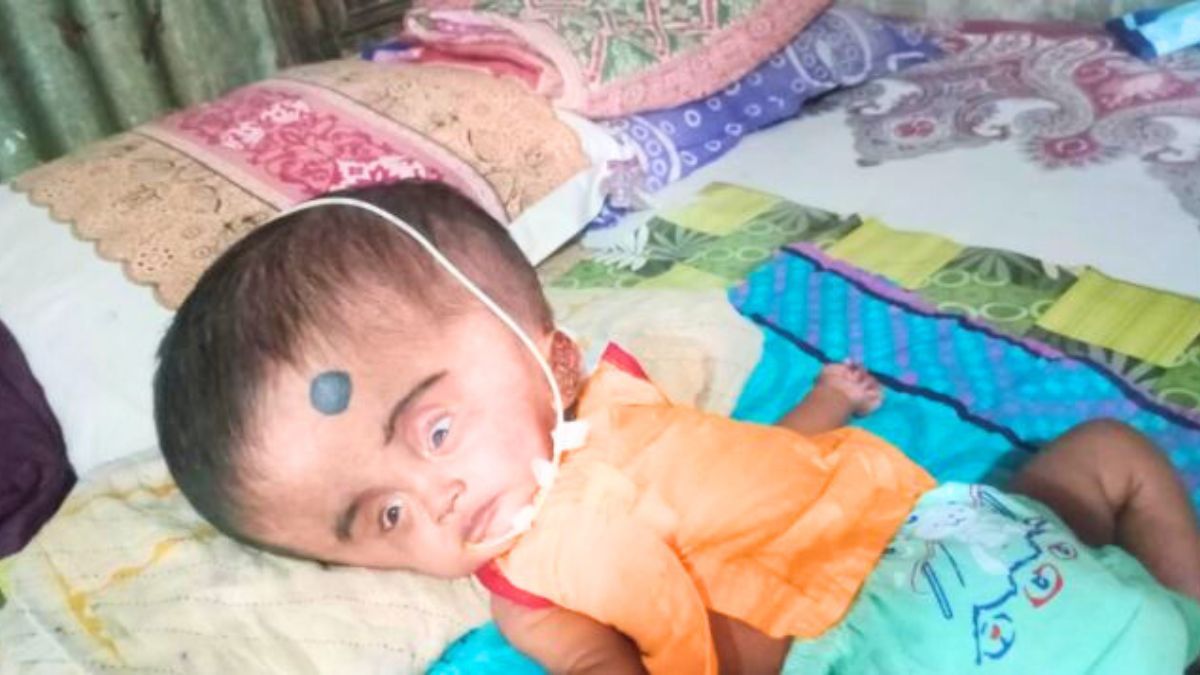 বাউফলে ৫৫ হাজার টাকায় বাঁচতে পারে অবুঝ শিশুর প্রাণ, সামর্থ্যবানদের এগিয়ে আসার আহ্বান