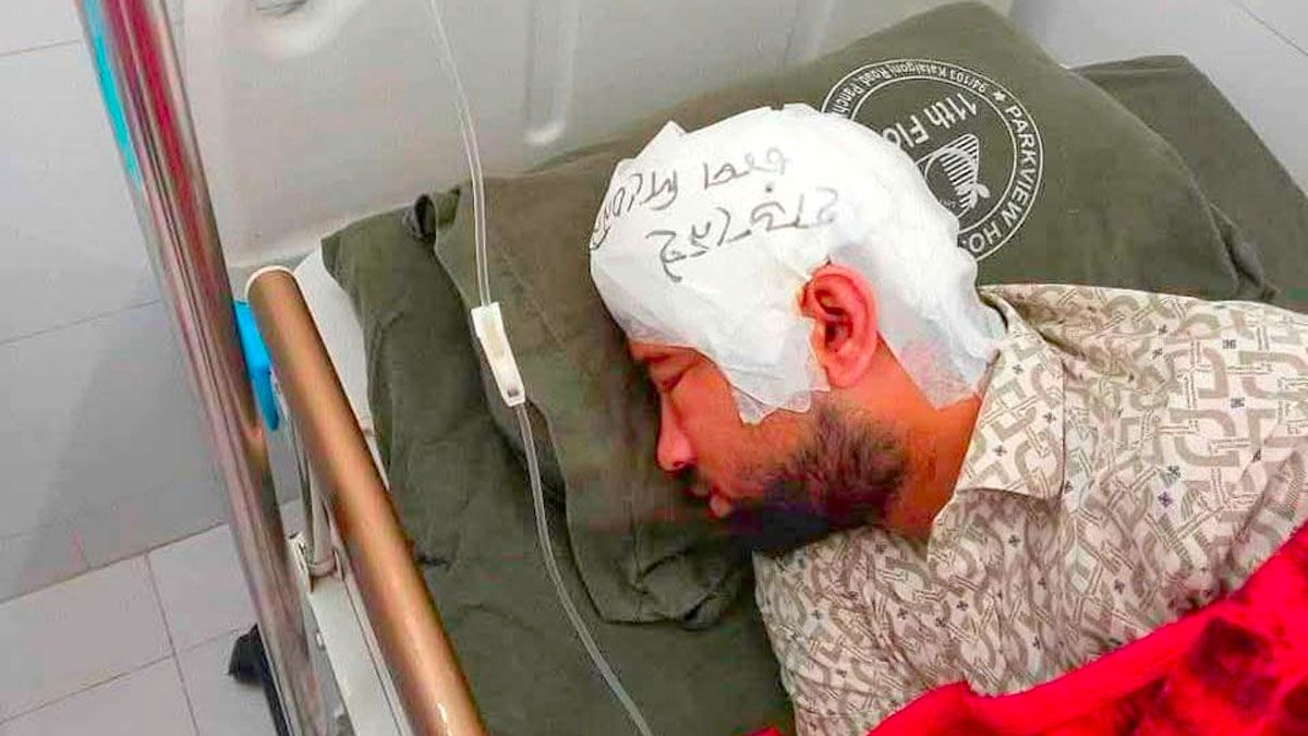 চবিতে সংঘর্ষ : মামুনের মাথায় লেখা ‘হাড় নেই, চাপ দিবেন না’