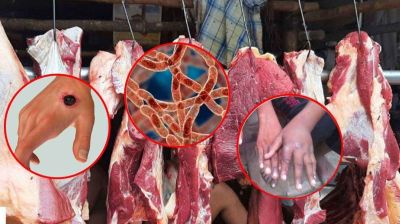 গাইবান্ধায় অ্যানথ্র্যাক্সের উপসর্গ নিয়ে নারীর মৃত্যু, আতঙ্কে এলাকাবাসী