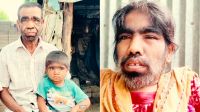 ইসলামপুরের ‘লোমশ পরিবারের’ জীবনযুদ্ধ
