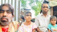 ইসলামপুরের ‘লোমশ পরিবারের’ জীবনযুদ্ধ