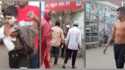 বিএনপির গণমিছিলের প্রস্তুতিকালে গ্যাস বেলুন বিস্ফোরণ, অর্ধশতাধিক দগ্ধ