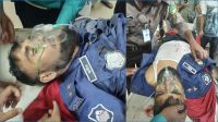 গাজীপুরে ট্রেনে কাটা পড়ে পুলিশ সদস্যের হাত-পা বিচ্ছিন্ন