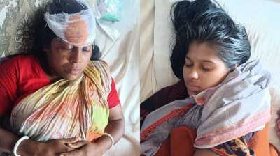 আলফাডাঙ্গায় তুচ্ছ ঘটনায় অন্তঃসত্ত্বাসহ একই পরিবারের ৩ জনকে পিটিয়ে জখম