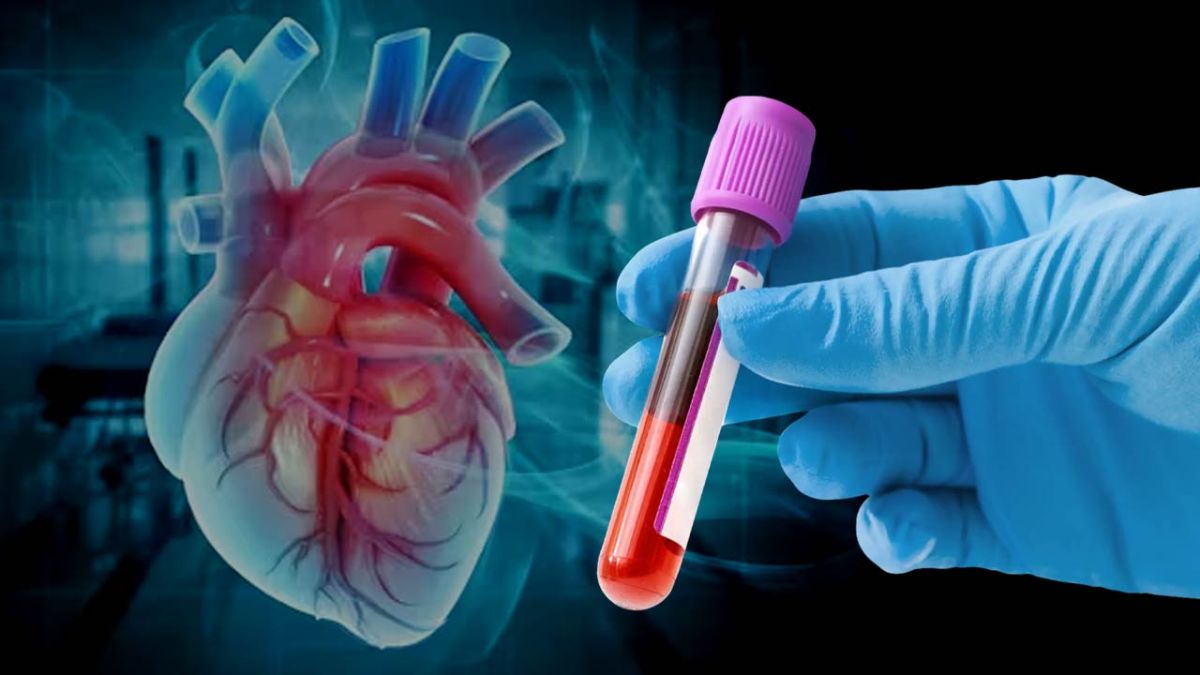 রোগীর প্রাণ বাঁচাবে রক্তের এক নতুন পরীক্ষায়