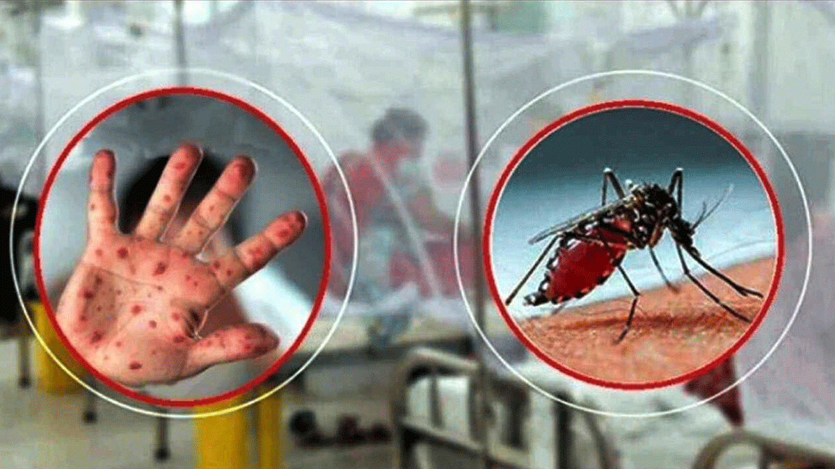 ডেঙ্গুতে একদিনে ১০ মৃত্যু, হাম উপসর্গে ৪